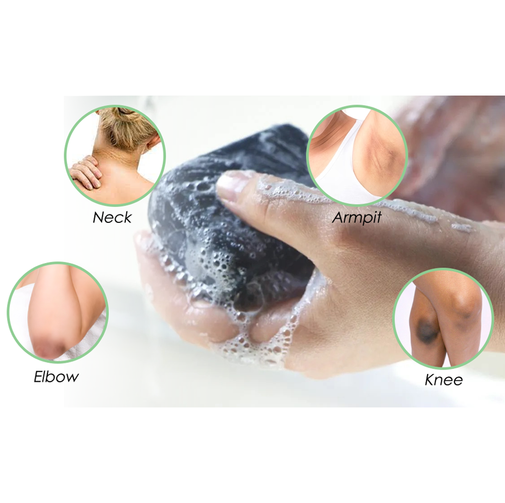 Jaysuing™ Acanthosis Nigricans Treatment Bamboo Charcoal Soap