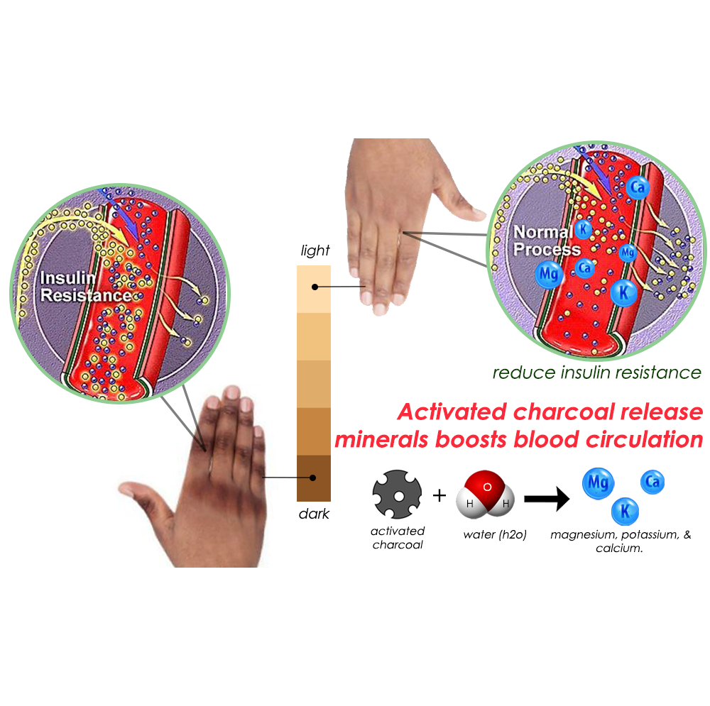 Jaysuing™ Acanthosis Nigricans Treatment Bamboo Charcoal Soap