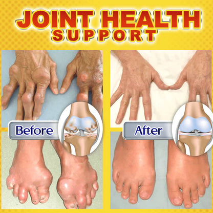 Gout Treatment Snake Venom Potent Ointment